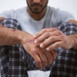 Psychological Injuries